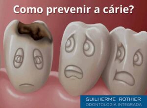 como-prevenir-carie-dentaria-dentista-ipanema-guilherme-rothier