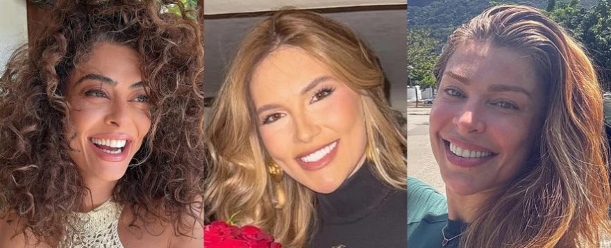 sorriso dos famosos lente contato dental